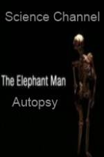 Watch Science Channel Elephant Man Autopsy Watch123movies