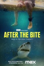 Watch After the Bite Watch123movies