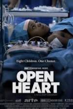 Watch Open Heart Watch123movies