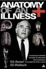 Watch Anatomy of an Illness Watch123movies