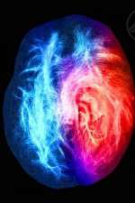 Watch Brain on Fire Watch123movies