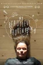 Watch My Beautiful Broken Brain Watch123movies