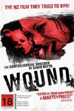 Watch Wound Watch123movies
