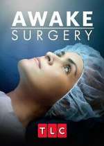 Watch Awake Surgery Watch123movies